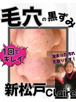 クレール 新松戸(Claire)/毛穴つるん♪毛穴ケア/角栓取り