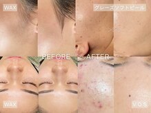 アンティエの雰囲気（圧倒的before after☆肌悩み別に最適メニューをご提案します！）