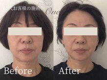 ワン(One)/たるみケアで印象はグッと変わる