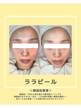 ソワナ(soina)/【神楽坂駅/フェイシャル/毛穴】