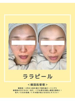 ソワナ(soina)/【神楽坂駅/フェイシャル/毛穴】