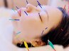 【熊本在住・当院初めての方限定】おためし美容鍼×電気2回〈70分〉★3,480円