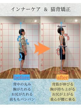 かんとま整骨院 中区鶴舞院/インナーケア猫背矯正で姿勢改善