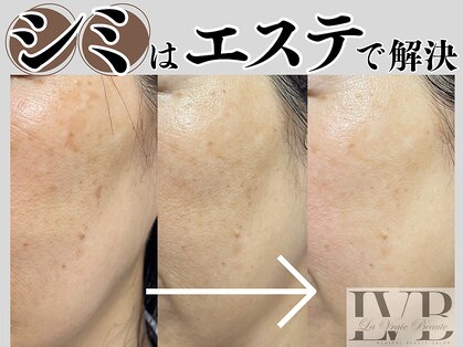 ラヴレボーテ(La Vraie Beaute)の写真