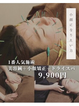 サルース(Salus)の写真/《圧倒的小顔効果》人気No.1美容鍼+小顔矯正¥9,900で理想のフェイスラインに♪クーポンページ要CHECK！