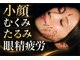 ヴィーライン 恵比寿本院(VeLine)の写真/芸能人御用達サロン★圧倒的施術実績と結果重視で小顔/むくみ/たるみ改善!《形状記憶美容鍼×頭の鍼￥9900》