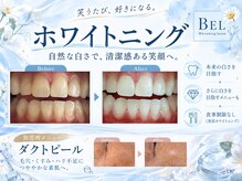 ベル(BEL)