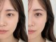 キュー 名駅(cue)の写真/【あなたが一番きれいに見える眉へ】骨格や眉の生え癖を見極め、理想の印象を追求する美眉アイブロウ