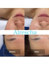 アルリシャ(Alrescha)/ゼロコルギフェイシャル