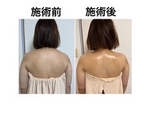 1回の施術でもむくみや姿勢が改善し、不調改善される方続出！