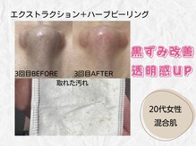 ミラ(Mira...)/☆Before→After☆