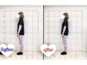 アモーラ(Amora)/カチカチに固まった身体をほぐす