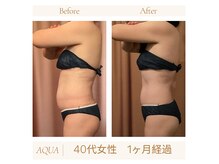 体のバランスを整えハイパーナイフでお悩みの根本的原因を改善