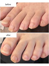 ケアプラス(care plus)/フットネイルケア