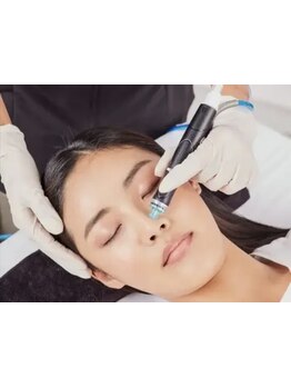 毛穴ケアをしたい