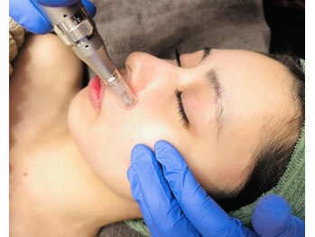 オルオル(Olu'olu)/レッドショット×エステダーマ