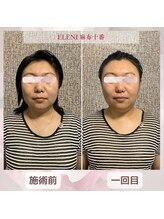 エレーニ 麻布十番(ELENI)/体が一回り小さく【小顔矯正】