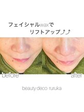ビューティーデコルルカ(beauty deco ruruka)/フェイシャルwax オススメ！
