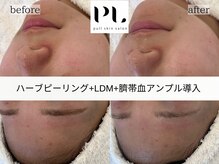 プルスキンサロン 大阪店(pull skin salon)/