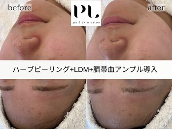 プルスキンサロン 大阪店(pull skin salon)/