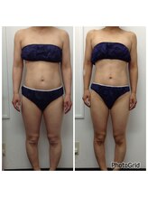 健康痩身研究所 名和店/ビフォーアフター