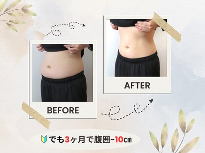 ピュア(Pure)の写真
