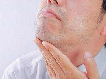 メンズエムボーテ 太田店(Men's M BEAUTE33)の写真/清潔感が格段に上がるメンズ脱毛！毛が少ないだけで、快適かつ清潔なライフ♪
