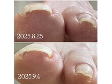 ケア ビューティー ネイル(care beauty NAIL)/