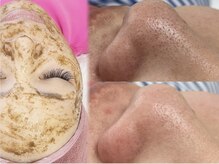 リベルキョウト 京都駅前店(Liber Kyoto)の雰囲気(ハーブピーリングx毛穴洗浄で即毛穴レス肌★)