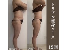 サロンドペシェ(salon de peche)/60代＊トリプル痩身コース