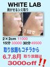 シミケア★ホワイトラボ6.7.8月取り放題は3000off 現金払お得に!