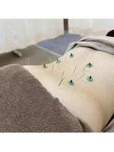 まごころ整骨院/鍼灸