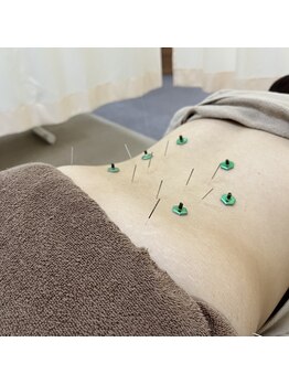 まごころ整骨院/鍼灸