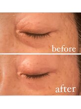 ジーニー(Genie)/ララピール始めました！