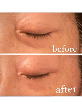 ジーニー(Genie)/ララピール始めました！