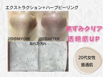 ミラ(Mira...)/☆Before→After☆