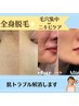 ●脱毛●【効率良く肌ケア】全身脱毛＋毛穴集中orニキビケア　¥15,400