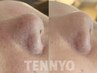 【エリア初★毛穴の黒ずみ＆角栓に】肌育毛穴洗浄TENNYO〈全顔〉 ¥6,800