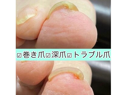 アメリ(Ameri)の写真