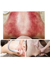 セレブリティ(Celebrity)/施術