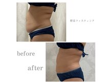 アデージョ アデオス(Ade-jyo.Adeosu)の雰囲気（ファスティング/体質改善/デトックス）