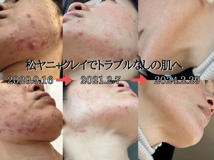フェミソワン(FemiSoin)の写真