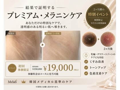 ユーエステティック(U AESTHETIC)の写真