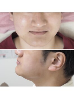ユニクリア 佐賀(Uniclear)の写真/【メンズ美容必見】自分磨き・婚活・ビジネスマン・パパ美容☆初めての美容デビュー多数!見た目を変える