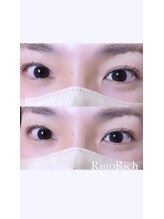 リノリッチ(RinoRich)/ラッシュリフト☆