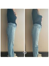 ブラックスワン(Black Swan)/