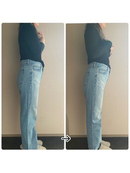 ブラックスワン(Black Swan)/