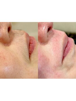 お肌をきれいにしたい