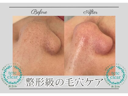 ドラーダ(DORADA)の写真