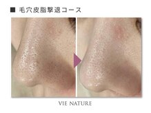 ヴィナチュール(vie nature)/ ■毛穴ケア
